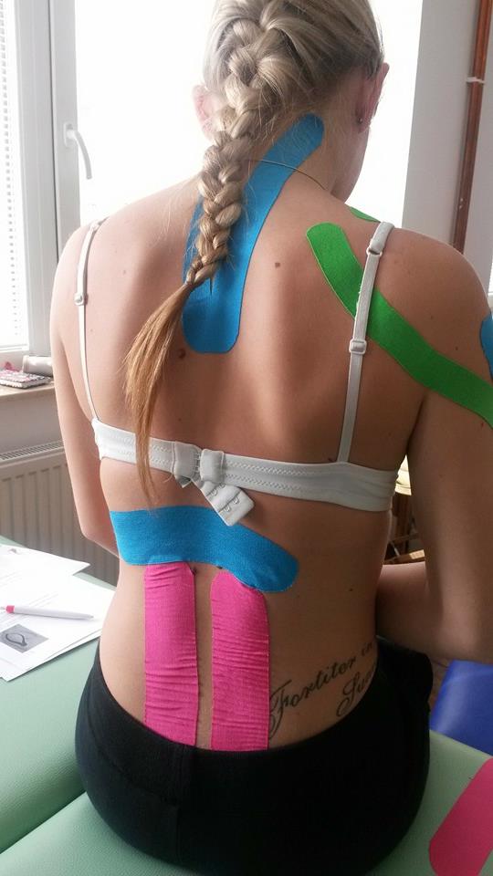 kineziotaping